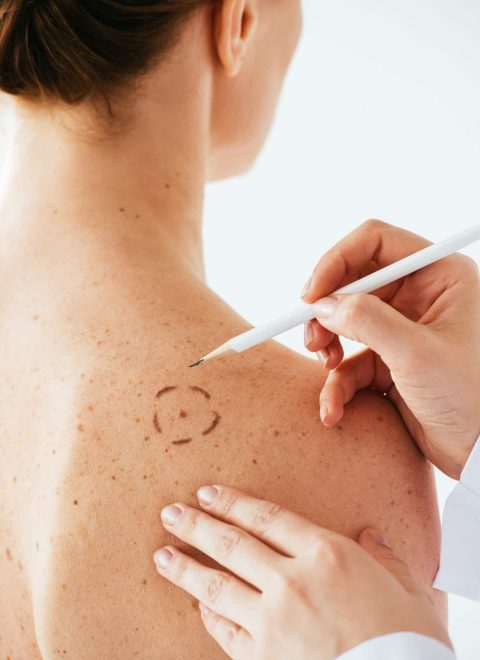 cropped view of dermatologist applying marks on skin of naked woman with pencil isolated on white